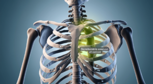 Densitométrie osseuse et cancer : rôle, indications et interprétations 4 Densitométrie osseuse et cancer : rôle, indications et interprétations